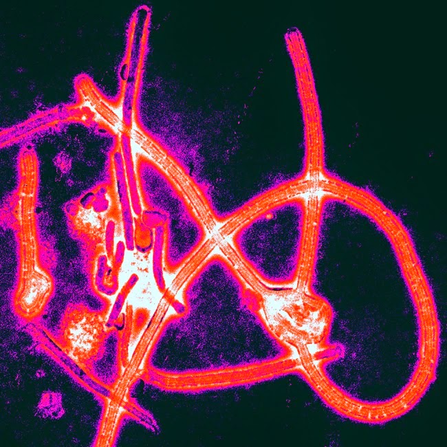 Ebola_virus_particles